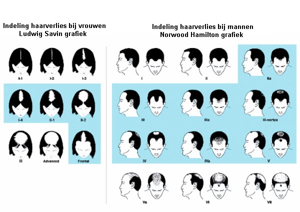 hairmax geschikt voor mannen en vrouwen met erfelijke haaruitval
